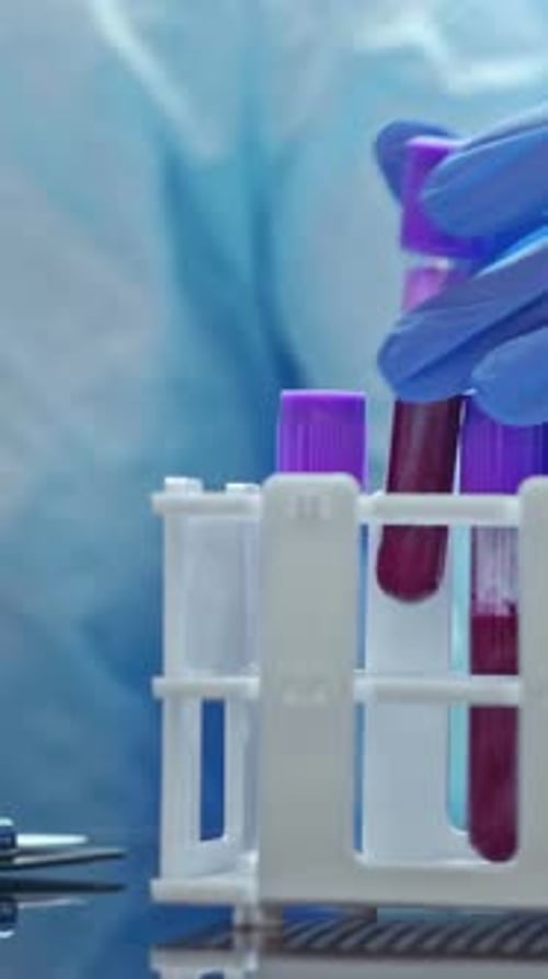 Laboratory Worker Handling Blood Sample Test Tubes
