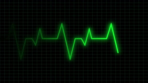 Hospital Heart Rate Monitor Screen Interface