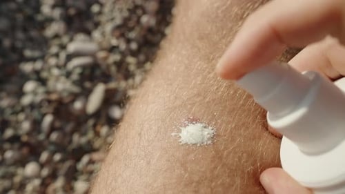 Protecting a Mole on the Skin from Sun Rays, Man Applying Sunscreen to a Red Mole on His Leg.