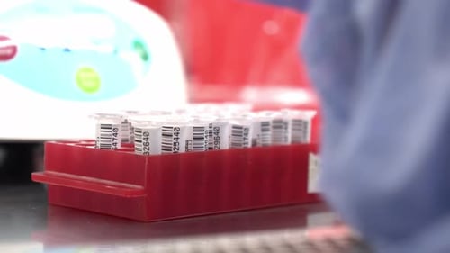 Red rack of labeled sample tubes in a clinical laboratory setting, close-up shot with soft focus