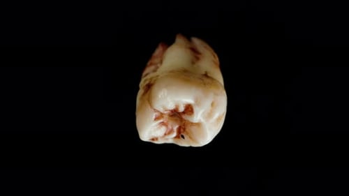Human Tooth in Blood Spins and Falls Down. Macro Super Slow Motion. Isolated.