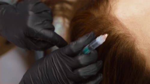 Injection being Administered to Scalp for Hair Growth
