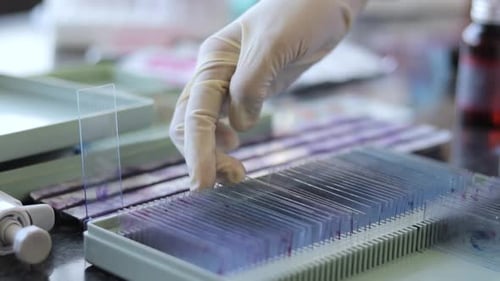Close up of Laboratory Assistant or scientist hands checking blood sample glass slides from the arch