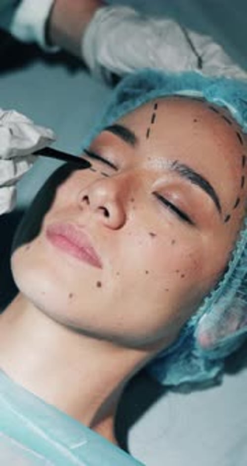 Frau, plastische Chirurgie und Gesichtszeichnung in der Klinik, Hände und Prozess der Schönheitstransformation