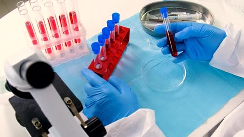 Lab Worker Placing Blood Sample in Rack