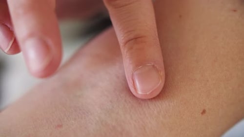 Finger Checks a Minor Wound on Arm