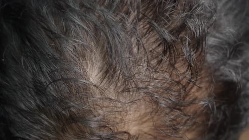 Close-up of short dark hair on head