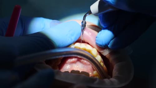 Dental Operation close up