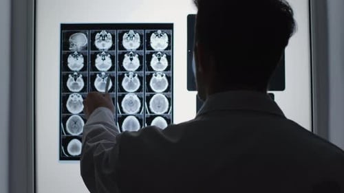 Radiologe analysiert Gehirn-CT-Scan