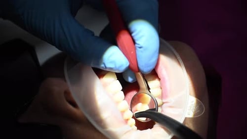 Dental Extreme Close Up Macro Video Dental Cleaning Process in Patient Mouth Clean Teeth with Water