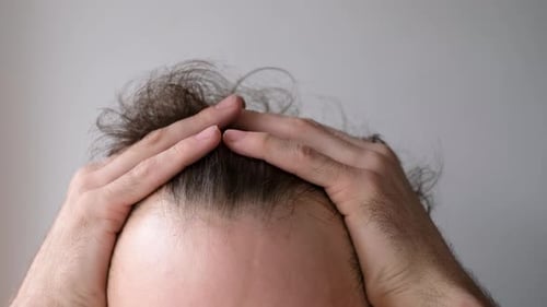 Man touching her hair close up on gray background, hair loss concept.