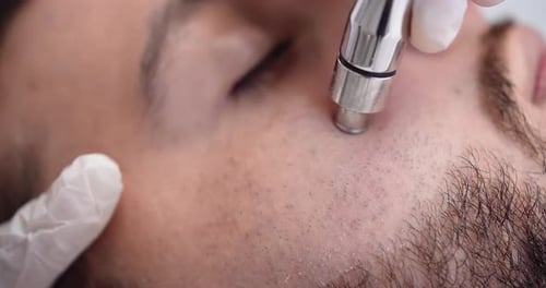 Young man receiving a beauty treatment with technological equipment in a dermatological clinic. 4K