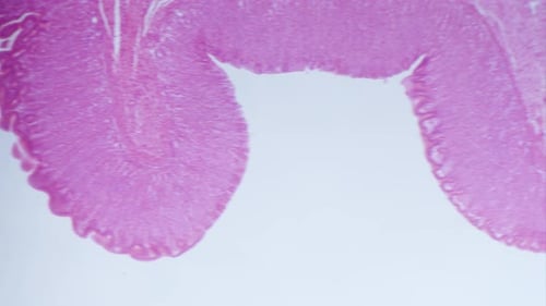 Biopsy Under Microscope