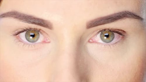 Human Close Up Eye Blinking, Blinking Eyes