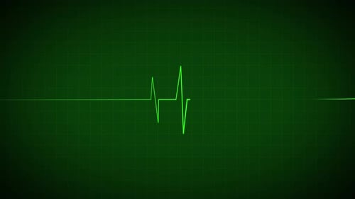 Digital Heartbeat Line on Monitor Screen Loop Animation