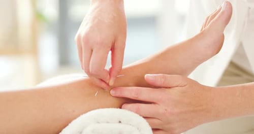 Therapist inserting acupuncture needles in clients lower leg, foot