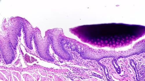 Amígdala palatina de ser humano filmada sob microscópio ampliada em 200 vezes devido a problemas médicos
