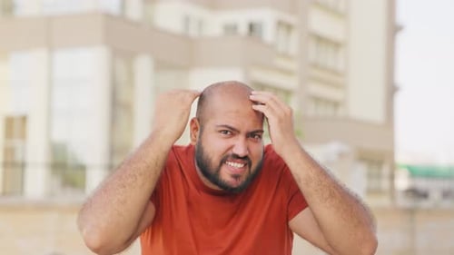 Bald indian Man Worried of Hair Loss