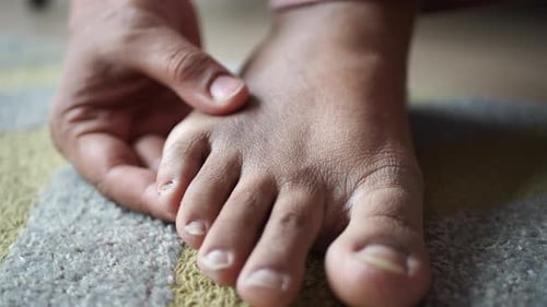 Nahaufnahme von geschwollenen Frauenfüßen