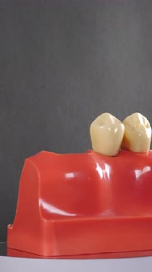 Dental Implant Model Rotating Close Up, Dental Health