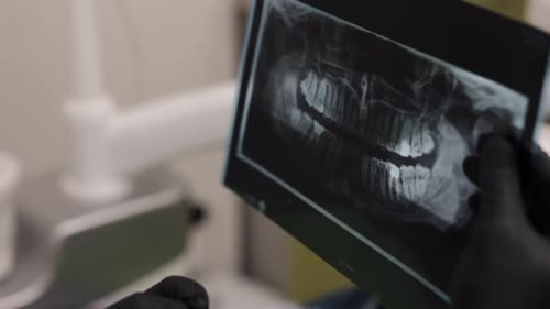 Radiographie dentaire en gros plan pour l'hygiène dentaire