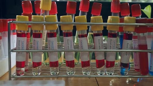Coronavirus Blood Samples in a Lab