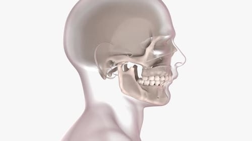 Orthognathic Surgery Lower Jaw