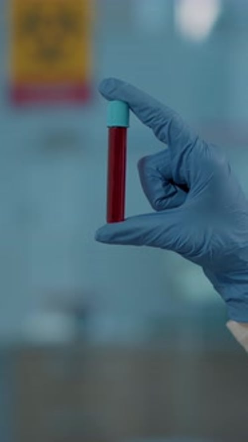 Hand with Glove Holding Test Tube of Blood