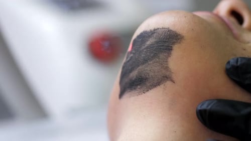 Laser Treatment on Face with Dark Paste