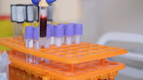 Blood Vials Being Placed in Tray