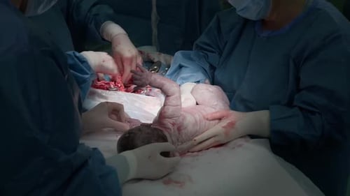 The Midwives Apply the Clamps so That the Surgeon Can Sew Up the Mother's Abdomen