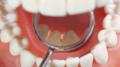 Patient at a Dentist Appointment in a Dental Clinic. View to Inside the Dental Jaw. Tooth Model