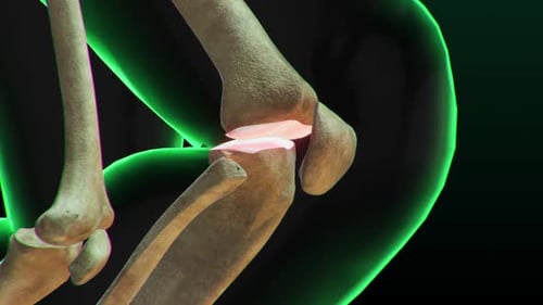 Animated Human Knee Joint and Cartilage Medical Explanation