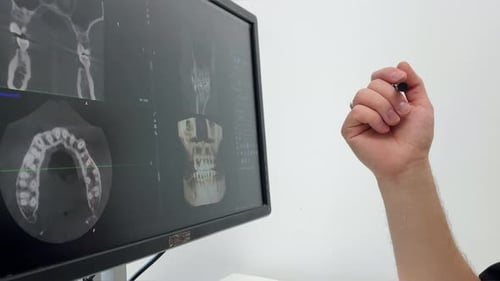 Dentist Doctor Examines a Panoramic Xray of the Jaw on a Computer Screen The Doctor Shows a 3D Model