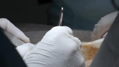 Close up of process of the real surgery at the hospital