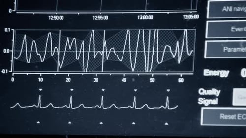Modern Patient Monitor
