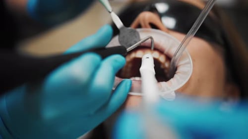 Ultrasonic Teeth Cleaning in Modern Dental Clinic Closeup View of Patient Teeth Professional