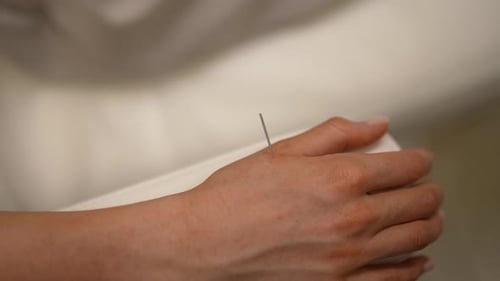 Akupunkturtherapie am Arm einer Patientin in einer chinesischen medizinischen Klinik, Nahaufnahme eines Jungen