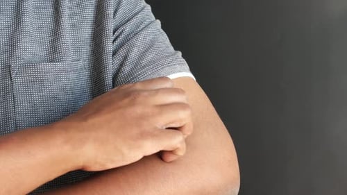 Hombre que sufre de picazón en la piel de cerca