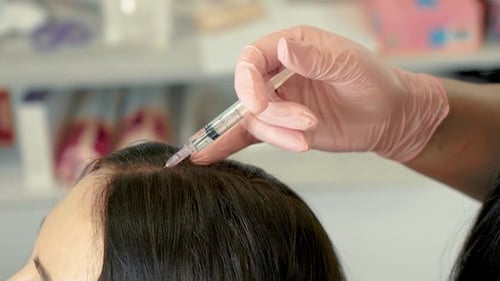 Medical Injection into Scalp of Person with Dark Hair