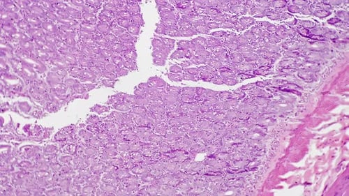Abschnitt des menschlichen Dickdarms, 100-fach vergrößert unter dem Mikroskop auf hellem Feldhintergrund gefilmt