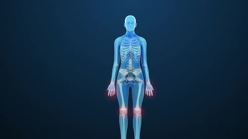 Medical Animation of Human Skeleton and Joint Pain