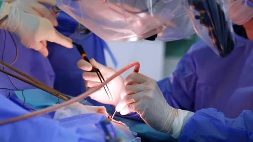 Surgeons perform delicate operation using microscope and tools