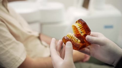 Modelo de dentista con guantes de látex sujetando mandíbulas humanas con aparatos dentales metálicos instalados