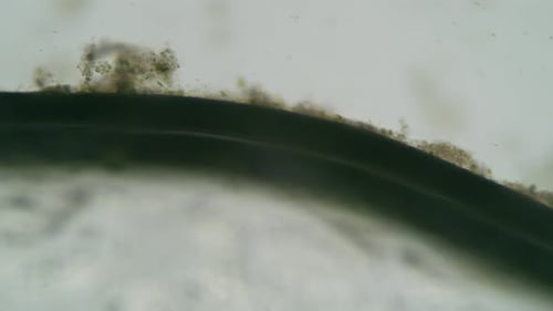 Contagion Collection: Microscopic algae element with soft focus