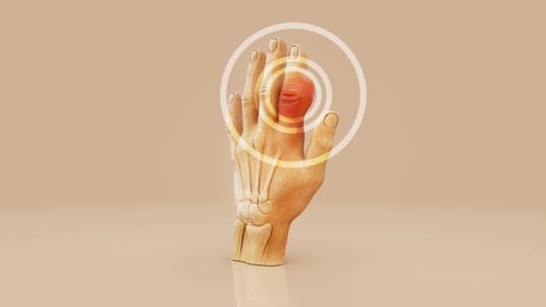 3D Hand Anatomy Animation with Joint Pain and Inflammation