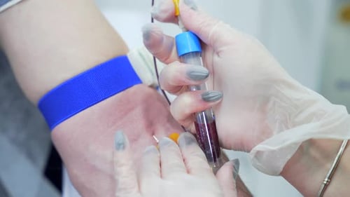 Ärztin in medizinischen Handschuhen entnimmt der Patientin eine Blutprobe, um im Krankenhaus auf Coronavirus zu testen