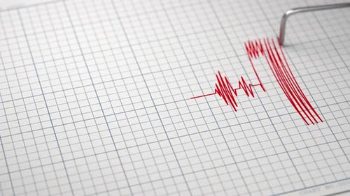 Polygraph Lie Detector is Drawing Truth on Diagram