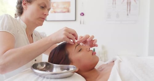 Thérapeute ciblé utilisant des aiguilles d'acupuncture sur le visage de clients hispaniques