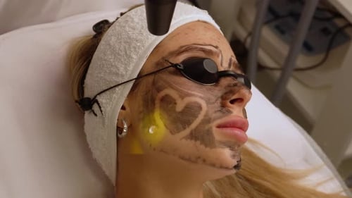Young Adult Woman Receives Carbon Peel Laser Treatment